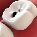 rigenerazione dentina