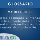 malocclusione