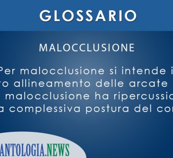 malocclusione